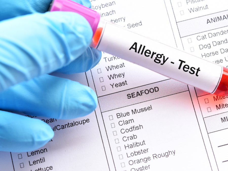 Allergy test
